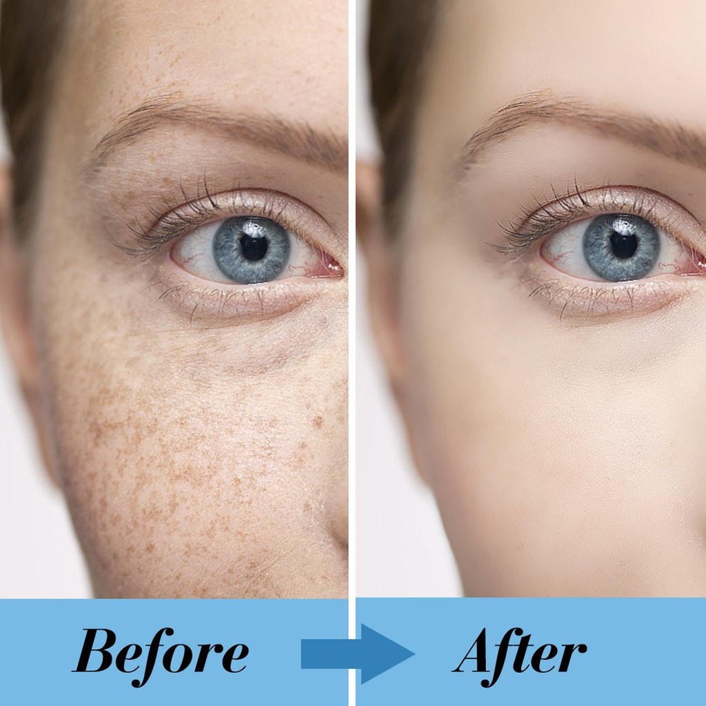 Brightening Serum: Let Dark Spots Fade Away